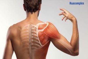 Hội chứng cổ vai cánh tay dẫn đến tình trạng đau vùng cổ, vai và một bên cánh tay