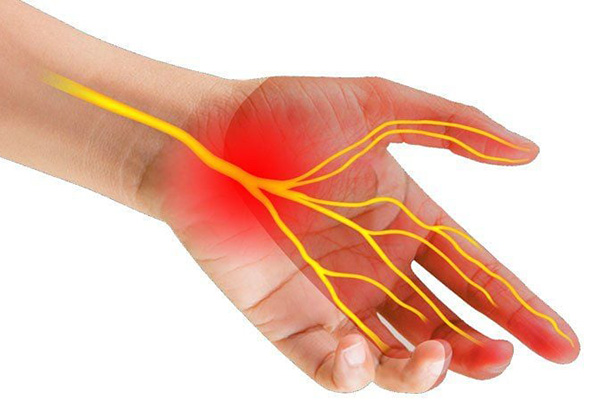 Bệnh gây đau, tê hoặc kim châm ở bàn tay và cổ tay