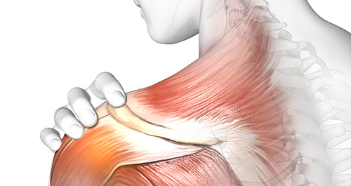 Viêm khớp vai và phương pháp điều trị