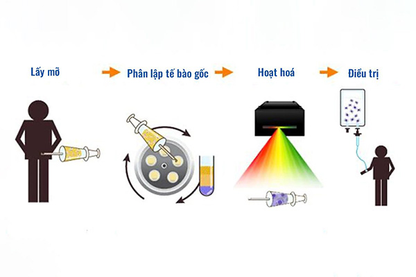 Liệu pháp được áp dụng điều trị cho thoái hóa khớp gối nguyên phát giai đoạn II-III