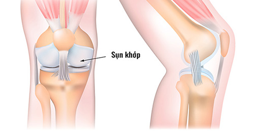 Chondroitin là thành phần quan trọng của khớp