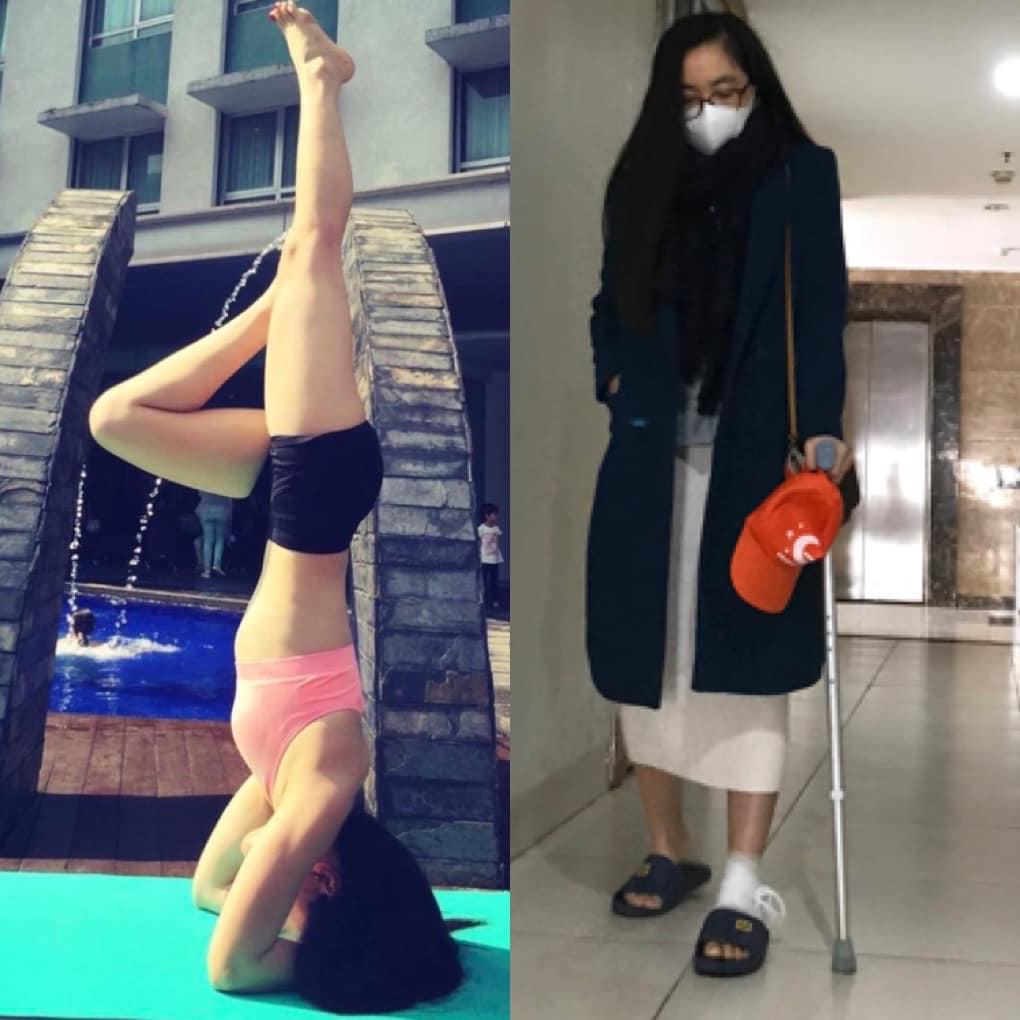 "Mình vốn tập yoga chăm chỉ mà năm ngoái chấn thương phải nghỉ suốt. Chống nạng như bà cụ luôn"